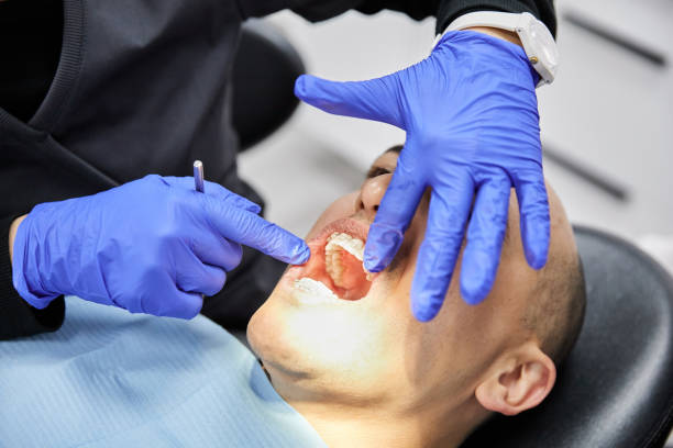 Best Emergency Dental Care for Abscessed Tooth in Tahoma, CA
